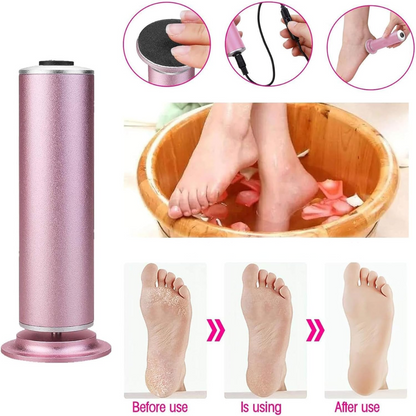 Aurellio™ PedicurePro Exfoliator
