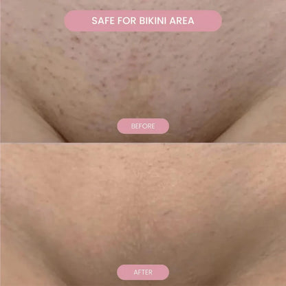 Luxe Serenity Shaver