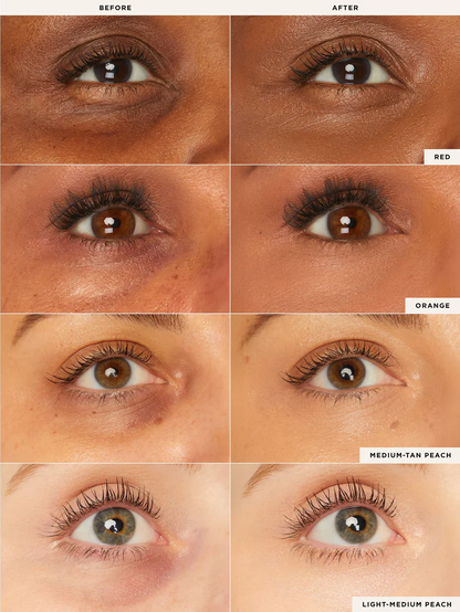 Sevani Colored Clay Undereye Corrector™