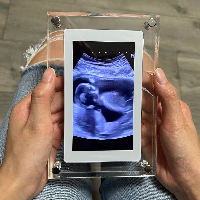 LuxeFrame™ Digital Frame