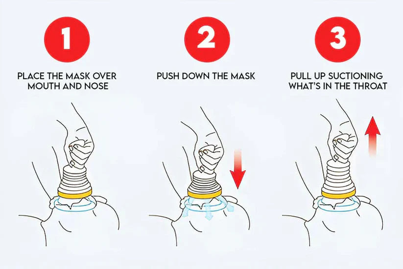 GuardianAir™ Anti-Choking Device